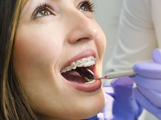 Why Are Orthodontics Needed